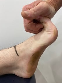 Testing foot arch by bending toes