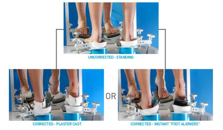 VFAS Custom Orthotic Technology